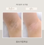 참슈가링왁싱