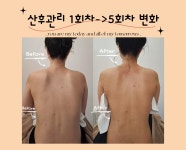 아이엔산모케어