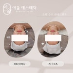 에움에스테틱