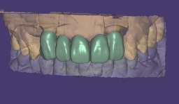 삼성치과기공소