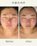 더좋은피부