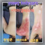 영바디케어