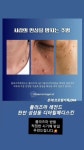 디어힐메디스킨