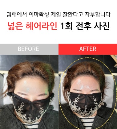 광고 이미지