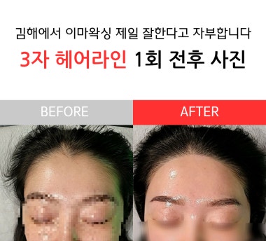 광고 이미지