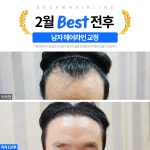 드림헤어라인의원