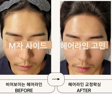 광고 이미지