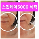 스킨케어5000