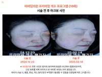 비바덤의원