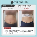 셀포랩 스타