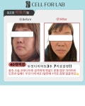 셀포랩 빅토리