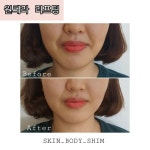 스킨앤바디 쉼