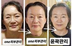 One피부관리