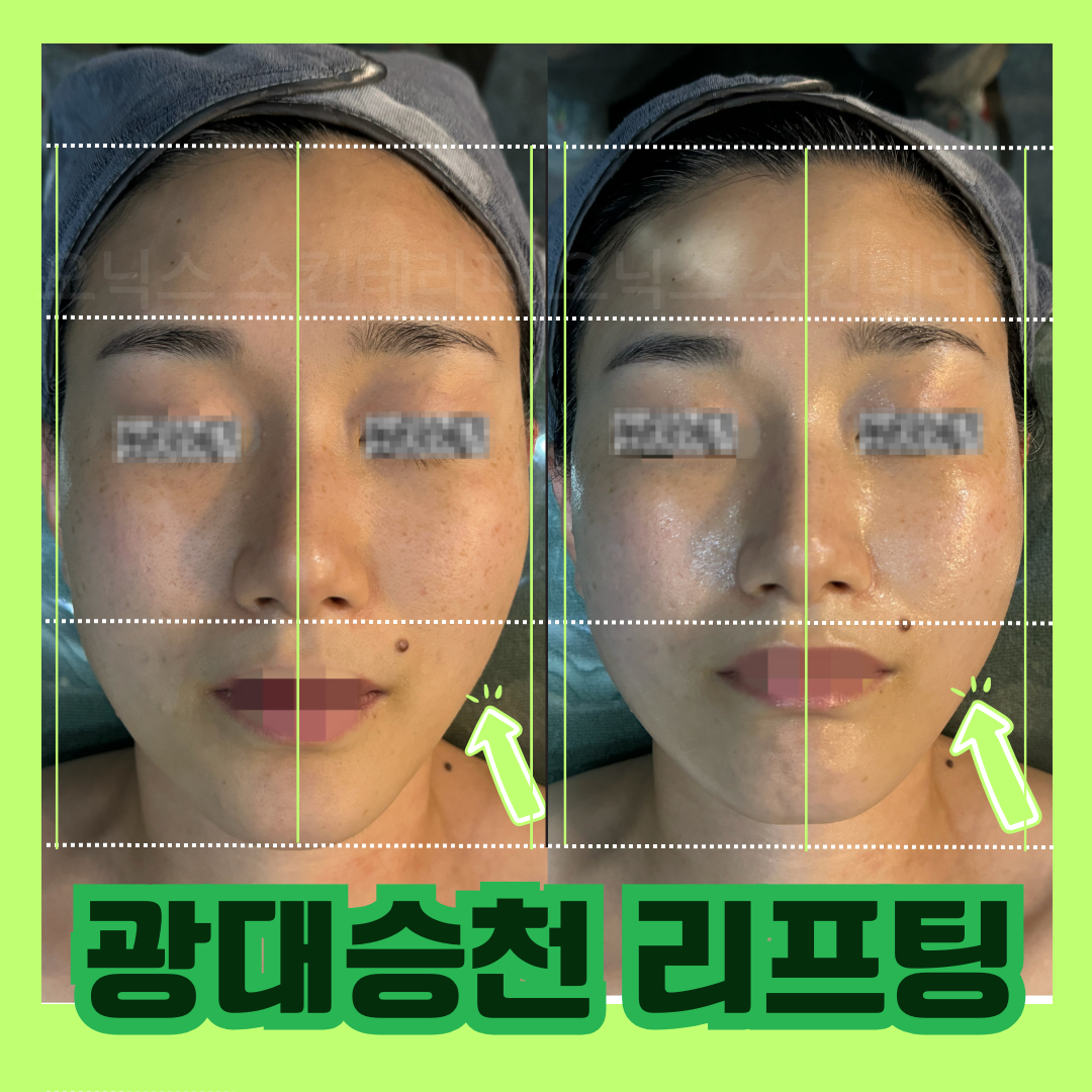 관련 이미지2