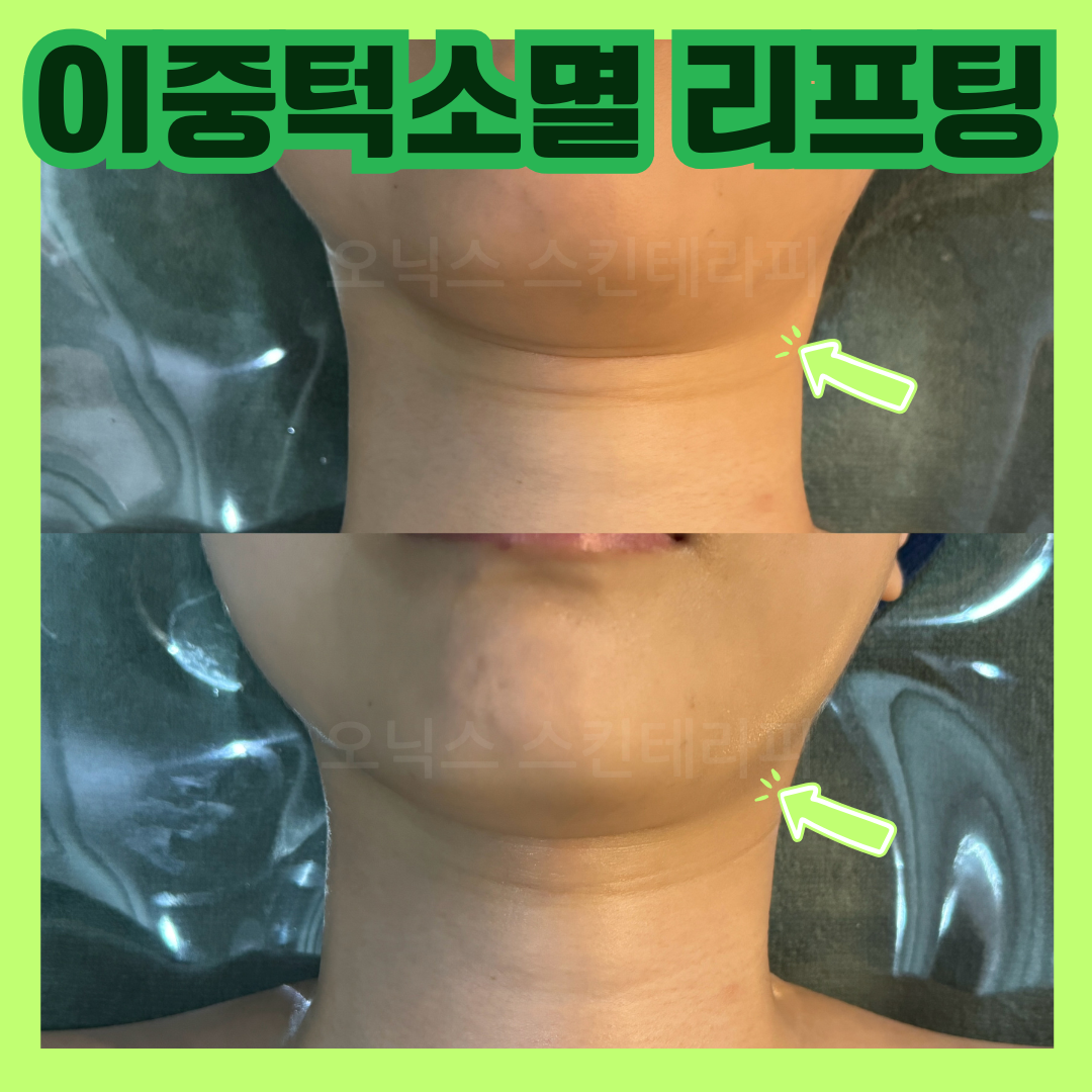 관련 이미지1