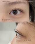 스칼프랩앤뷰티 속눈썹&눈썹&탈모 의정부점