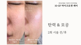엘슈가링왁싱 수원인계점