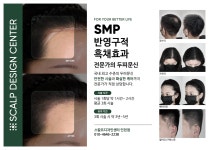 스칼프디자인센터 인천