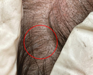 리게인프로젝트 대구본점