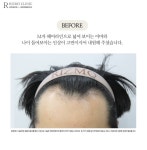 리즈모의원 부산