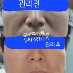 뷰티스스킨케어 | 뷰티스킨케어
