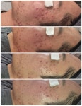 김포 구래 피부관리 오늘도 예쁨