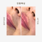 피부엔바디