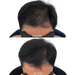 림스칼프 대구본점