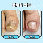 푸스케어 평택비전점