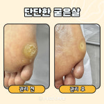 푸스케어 평택비전점