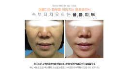 생강의료생활협동조합 돋움의원