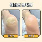 푸스케어 평택비전점