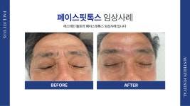 이수피부관리 키미스킨앤뷰티/스킨플래닝
