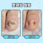 푸스케어 평택비전점