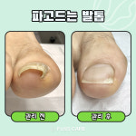 푸스케어 평택비전점