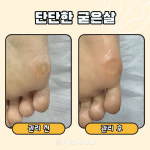 푸스케어 평택비전점