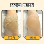 푸스케어 평택비전점