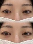 미그리다뷰티