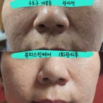 뷰티스스킨케어 | 뷰티스킨케어