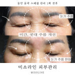 미소라인 피부관리