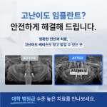 서울식플란트치과의원
