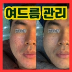 오닉스 스킨테라피 왕십리본점