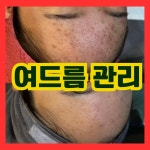 오닉스 스킨테라피 왕십리본점