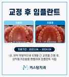 커스텀치과의원 부천 중동