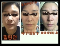 휴피부관리실