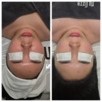 뷔에고에스테틱 김포점