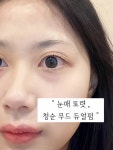 아끌래쉬