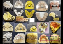 맞춤치과기공소