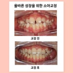 휴플러스치과의원