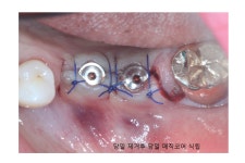 덴타피아치과의원